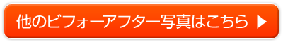 他のビフォーアフター写真はこちら 》