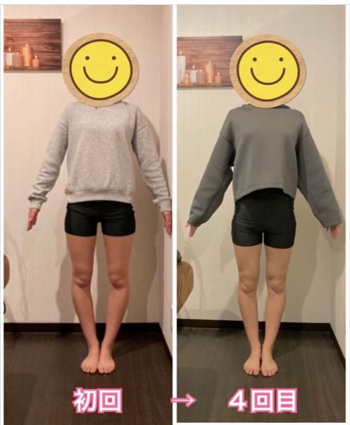 O脚矯正 | 美ボディ整体院 橿原店